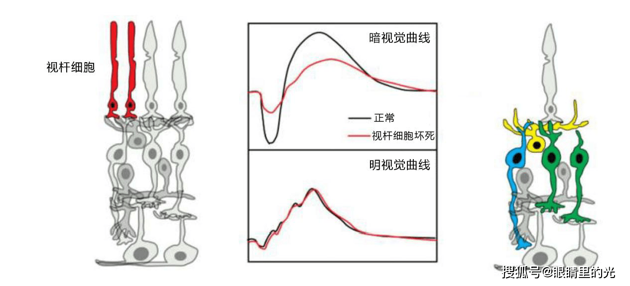 视杆细胞(图1)