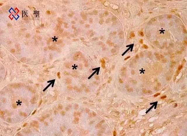 深度解析 | 一文读懂iPS（诱导多能干细胞）(图5)