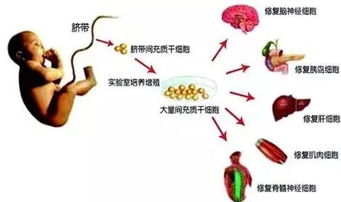 人类即将进入细胞时代，干细胞攻克慢性疾病(图4)